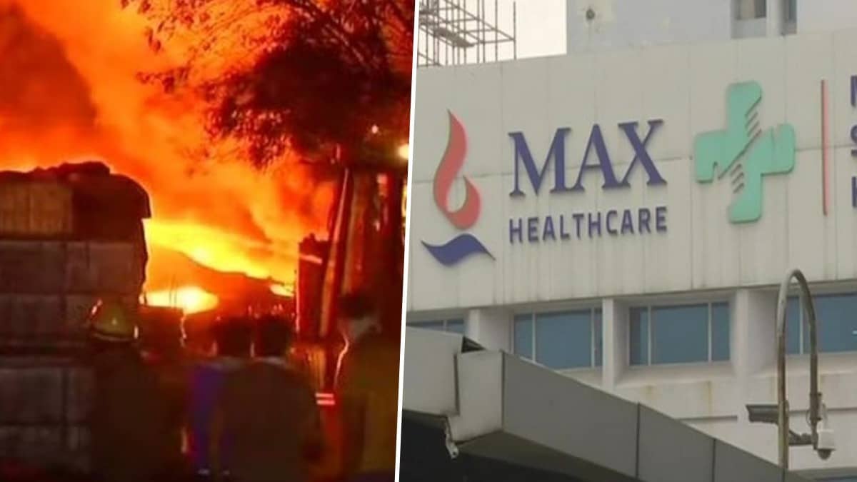 13 International Patients from Malviya Nagar Fire Incident in Stable Condition at Max Hospital Saket