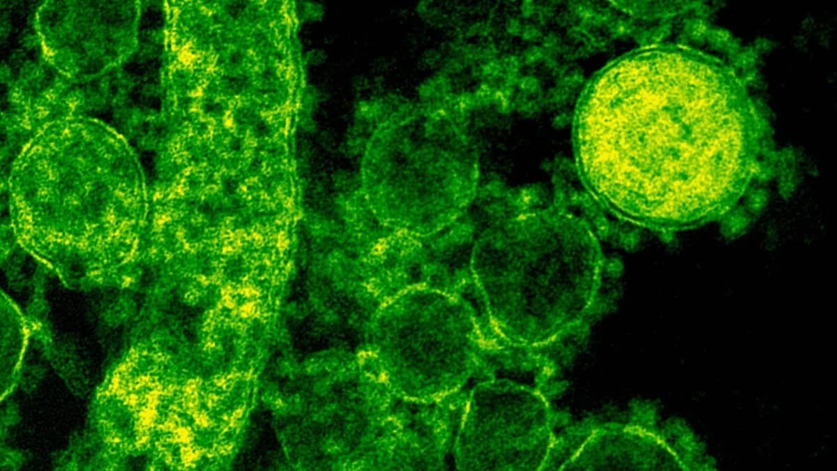 Kerala Health Alert: 70 Shigella Cases and 5 Deaths in a Month, Kozhikode and Mallapuram Emerge as Worst Hit Districts