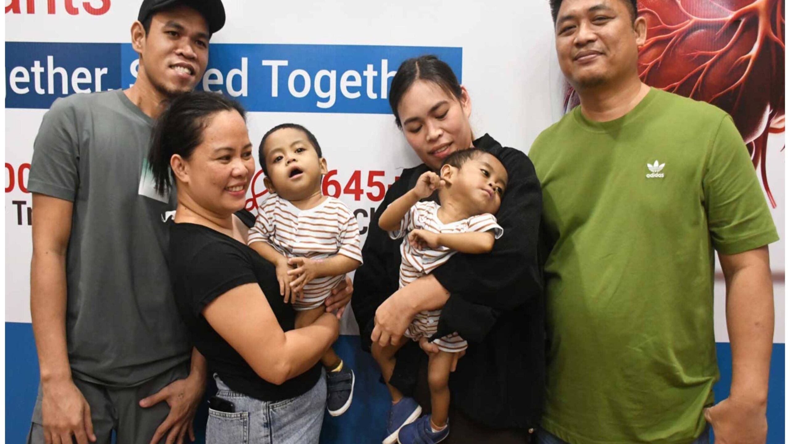 23-Month-Old Filipino Twin Brothers Get New Lease Of Life Through Rare Twin Liver Transplants
